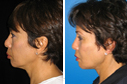 Before & After Photos